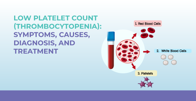  Platelet-lowering treatments in certain cases