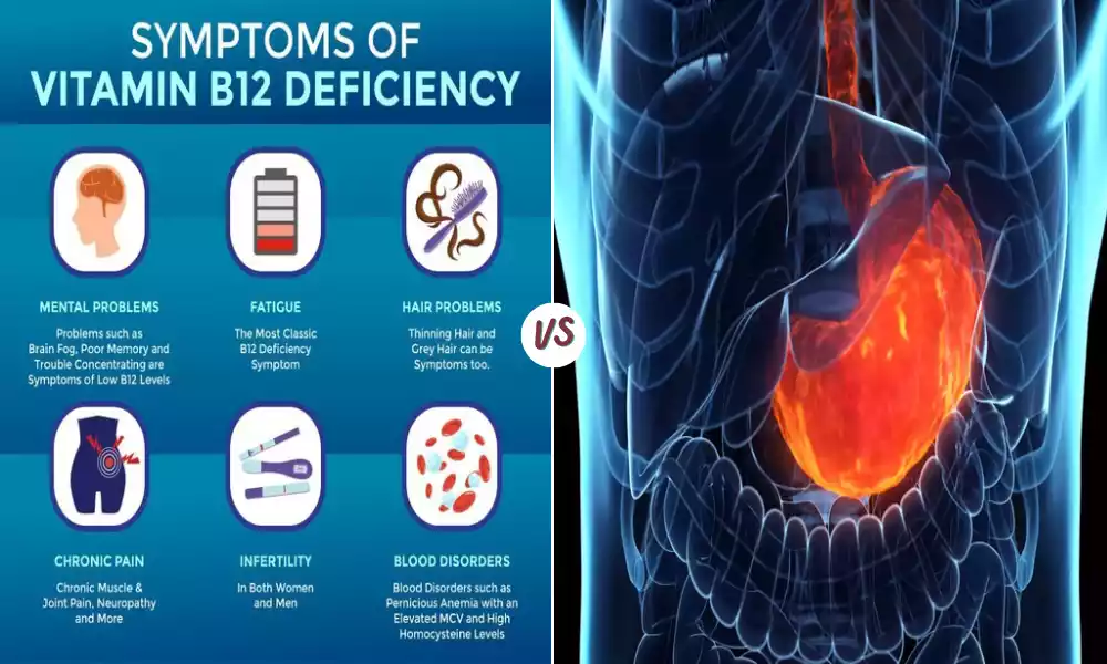 Difference Between B12 Deficiency and Pernicious Anemia