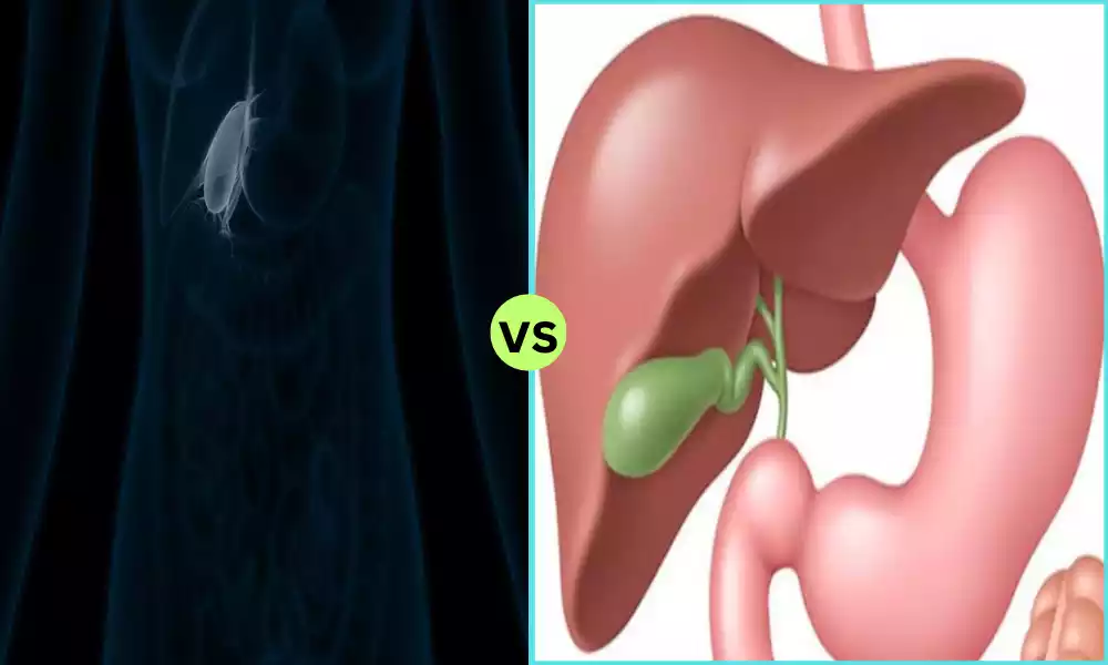 Best 8 Between Biliary Colic and Cholecystitis