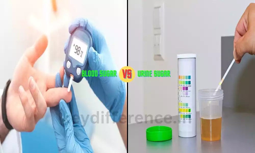 Understanding the Difference Between Blood Sugar and Urine Sugar