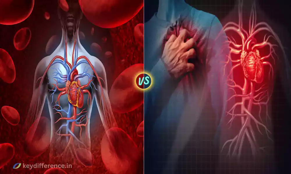 Coronary Heart Disease and Cardiovascular Disease