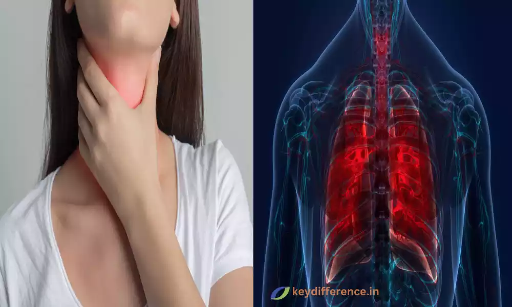 Sarcoidosis and Tuberculosis