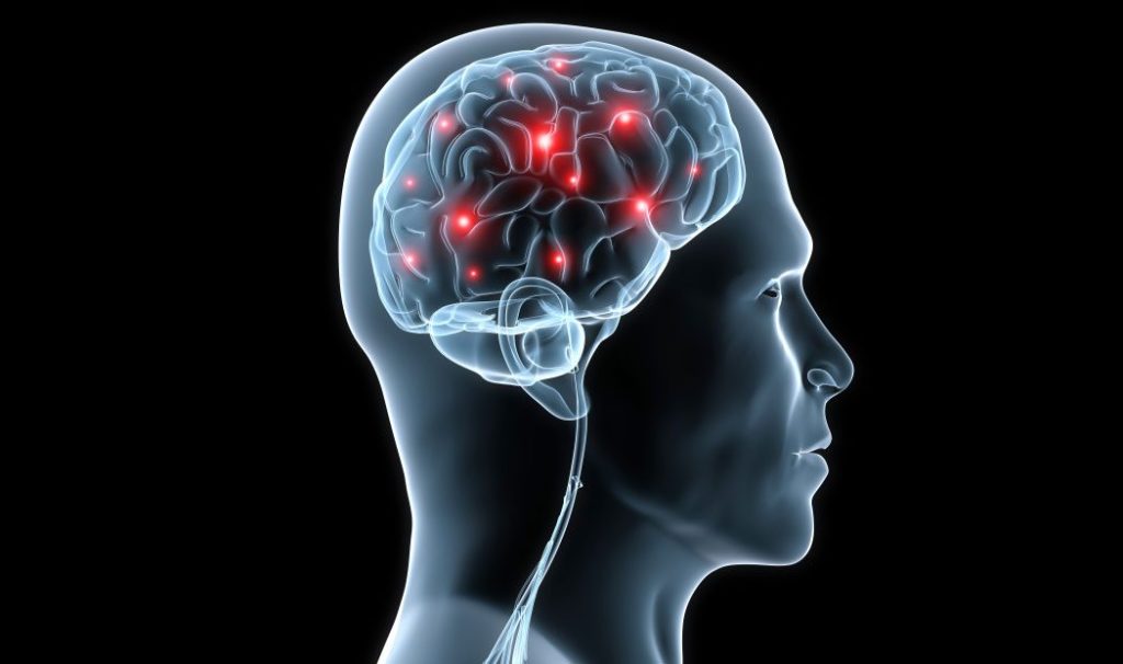 Difference Between Frontotemporal Dementia and Vascular Dementia