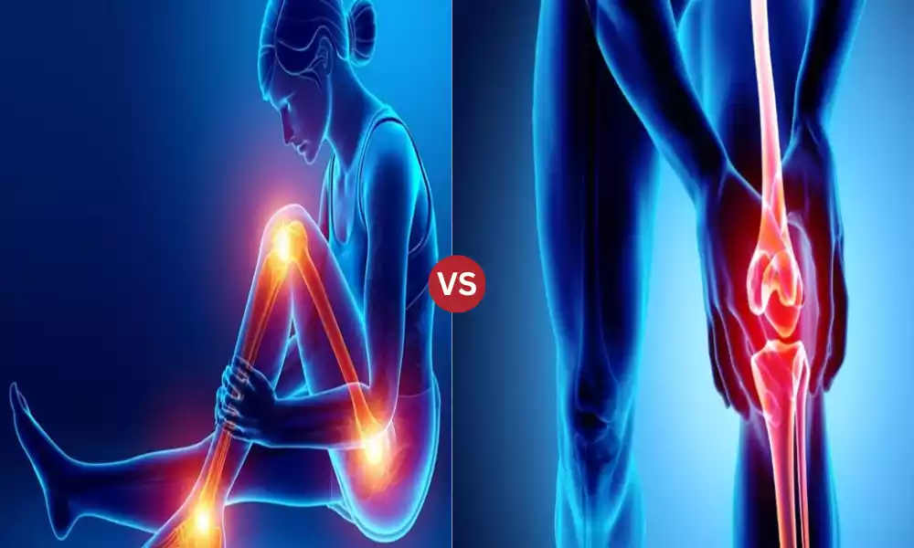 TOP 9 Difference Between Arthritis and Osteoarthritis