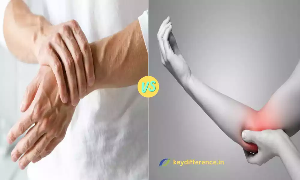 Difference Between Cubital and Carpal Tunnel Syndrome