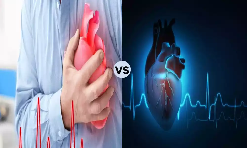 Difference Between Heart Palpitations and Arrhythmia