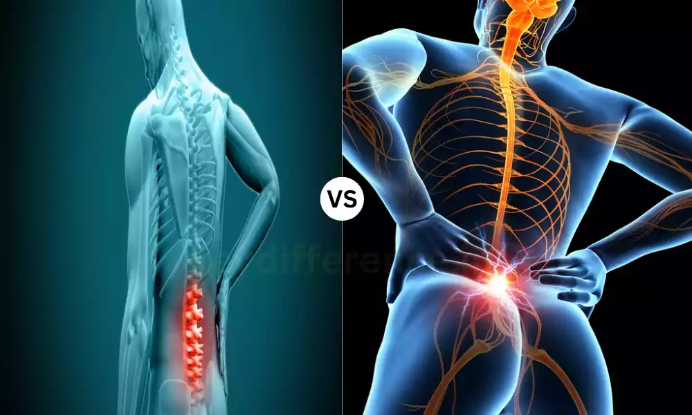 Herniated Disc and Piriformis Syndrome
