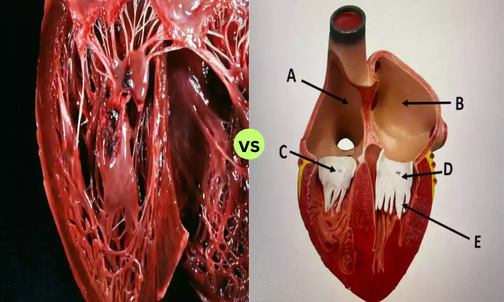 What is the Difference Between Papillary and Pectinate Muscles