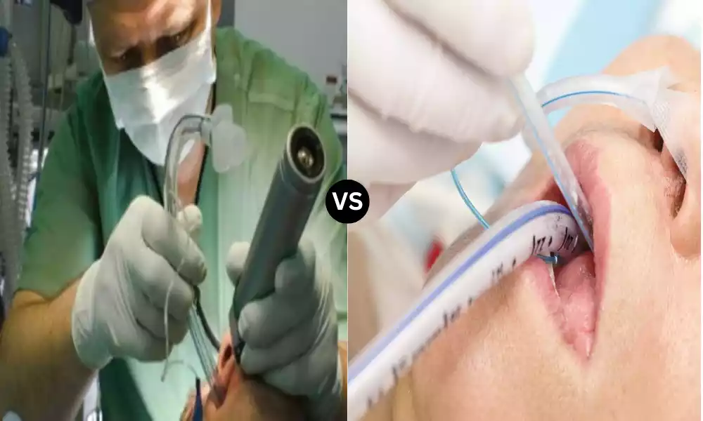 Best 9 Difference Between Rapid Sequence Intubation and Normal Intubation