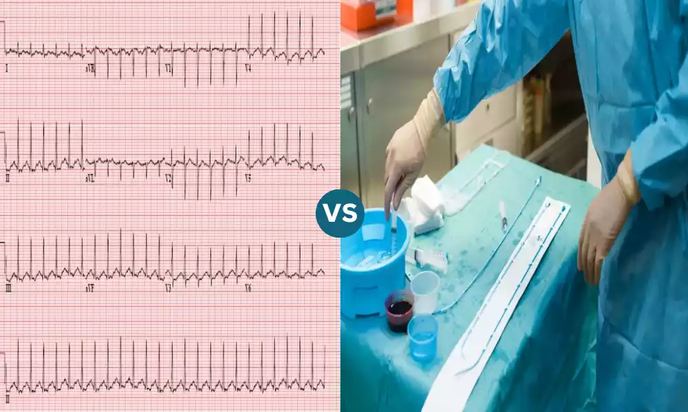 Difference Between Sinus Tach and SVT