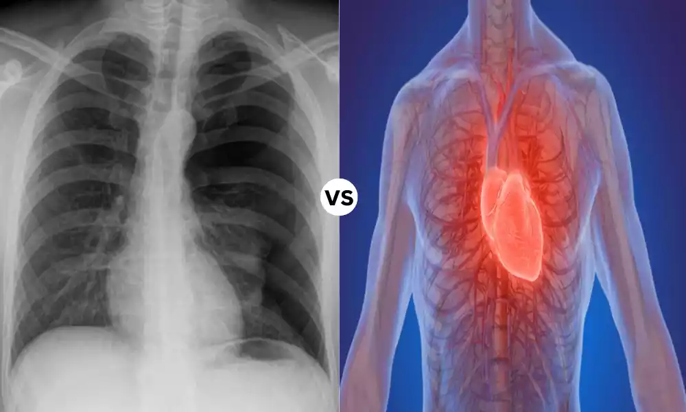 Tension Pneumothorax and Cardiac Tamponade