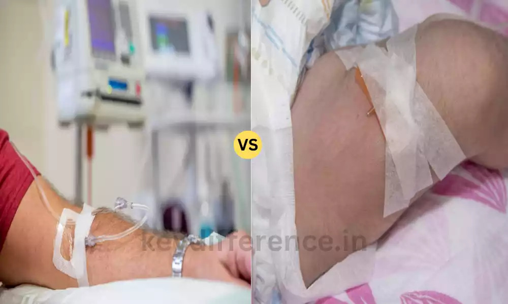 Difference Between IVIG and SCIG