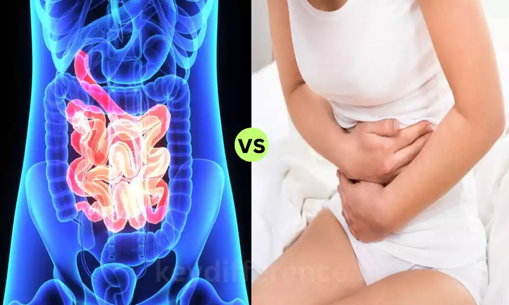Difference Between Malabsorption and Maldigestion