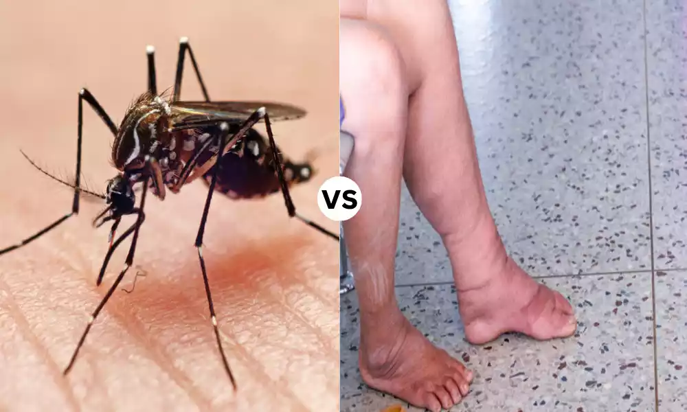 Best 11 Difference Between Malaria and Filariasis